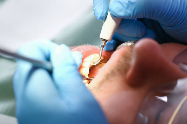 Best Emergency Care for Gum Disease in Fowler, MI